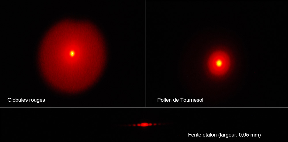 Image de granulométrie sur globule rouge ©Rob in Space